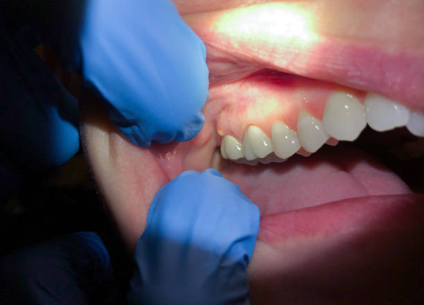 Best Tooth Pain Emergency Relief  in Bluefield, VA
